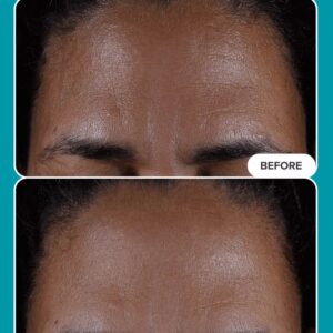 2% BHA Liquid Exfoliant - Image 4