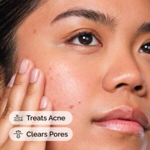 Salicylic Acid 2% Solution - Image 2
