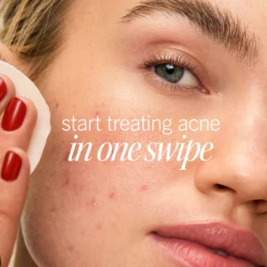 First Aid Beauty Blemish Control Pads - Image 2