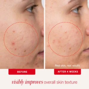 First Aid Beauty Blemish Control Pads - Image 3