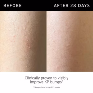 The Inkey List Glycolic Acid Exfoliating Body Stick, Size: 1.5 oz - Image 4