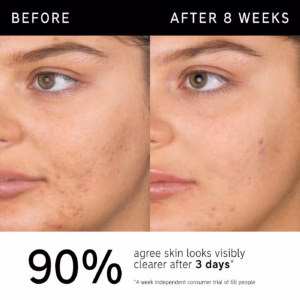 Inkey list Salicylic Acid Cleanser - Image 6