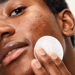 First Aid Beauty Blemish Control Pads - Image 7