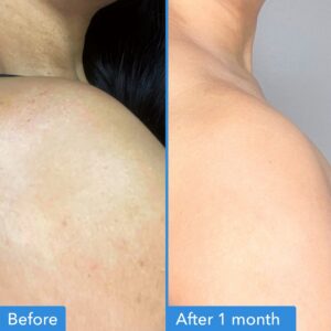 Good Molecules Discoloration Correcting Body Treatment - Anti-Pigment Cream with Niacinamide, Tranexamic Acid - Target Dark Spots and Moisturize - Image 3