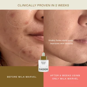 Eadem Milk Marvel Dark Spot Serum, Vitamin C Face Serum Infused with Niacinamide, Dark Spot Remover for Face and Body, Natural Dark Spot Corrector for Skin Care, 1 Oz - Image 6