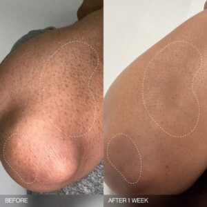 Slather Exfoliating & Smoothing Bar (2 Pack) – Retinol Body Bar for KP, Dry & Textured Skin – Hydrating, Smoothing - Image 4